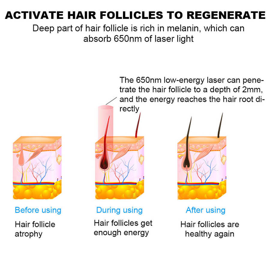 H-Lab Wireless Hair Growth LED Helmet