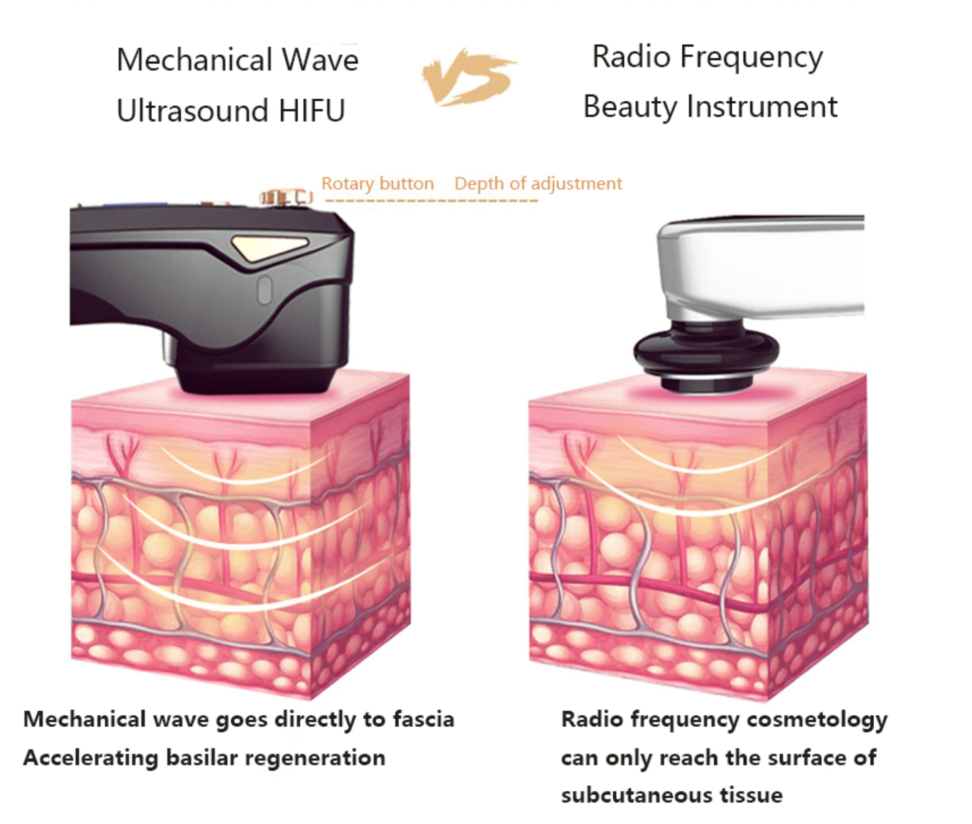 HIFU, RF, sagging skin, lifting, SMAS